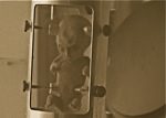 1_fetus